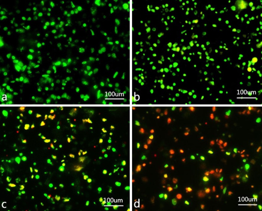 吖啶橙AO/EB雙熒光染色試劑盒